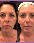 Beauty Microcurrent Facial Toning Massager